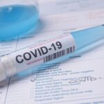 Required COVID travel test in Italy for safe and hassle-free travel during the pandemic