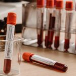 COVID tests for Italy travel: important for entry requirements